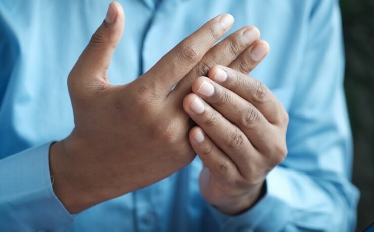 persona in camicia blu che mostra l'infiammazione della mano sinistra